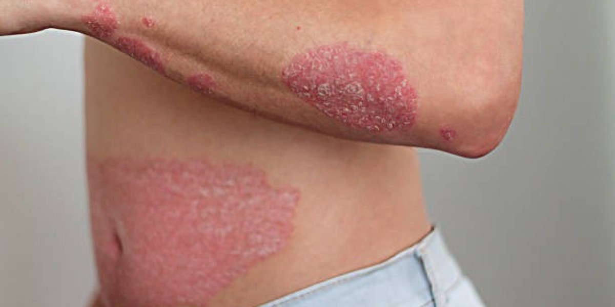 What Are Common Skin Lesions That Require Removal?
