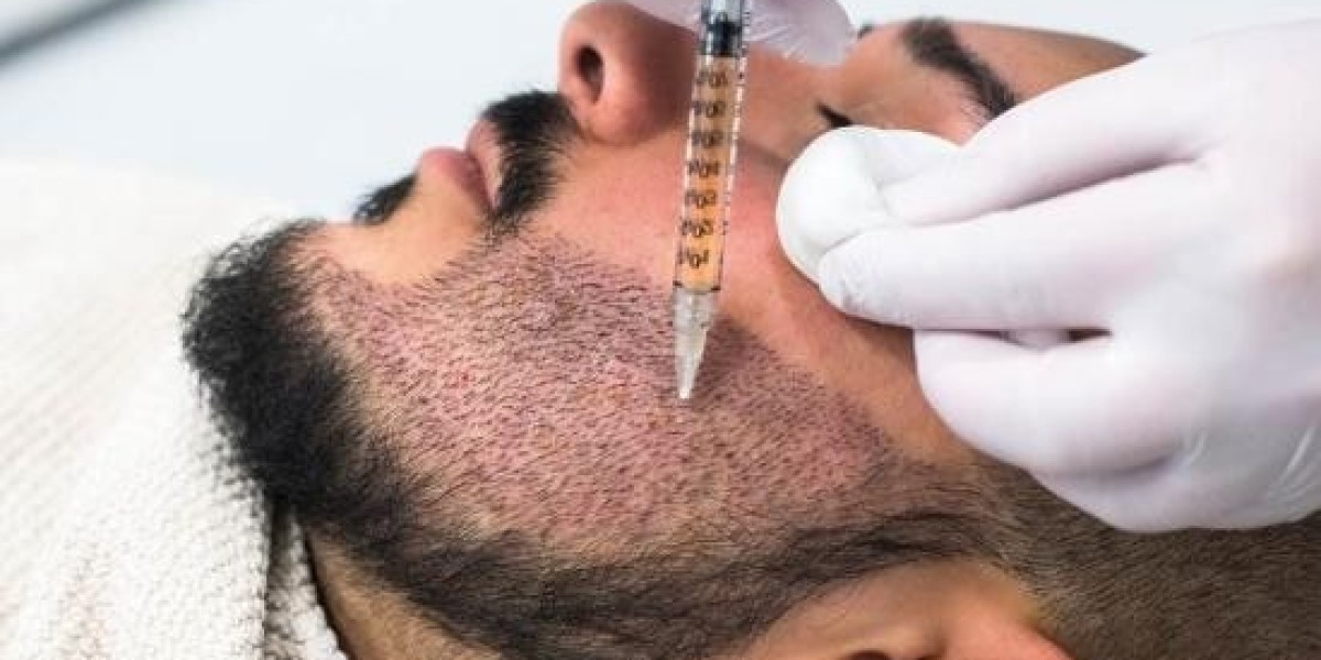 The Role of Platelet-Rich Plasma (PRP) in Beard Transplant