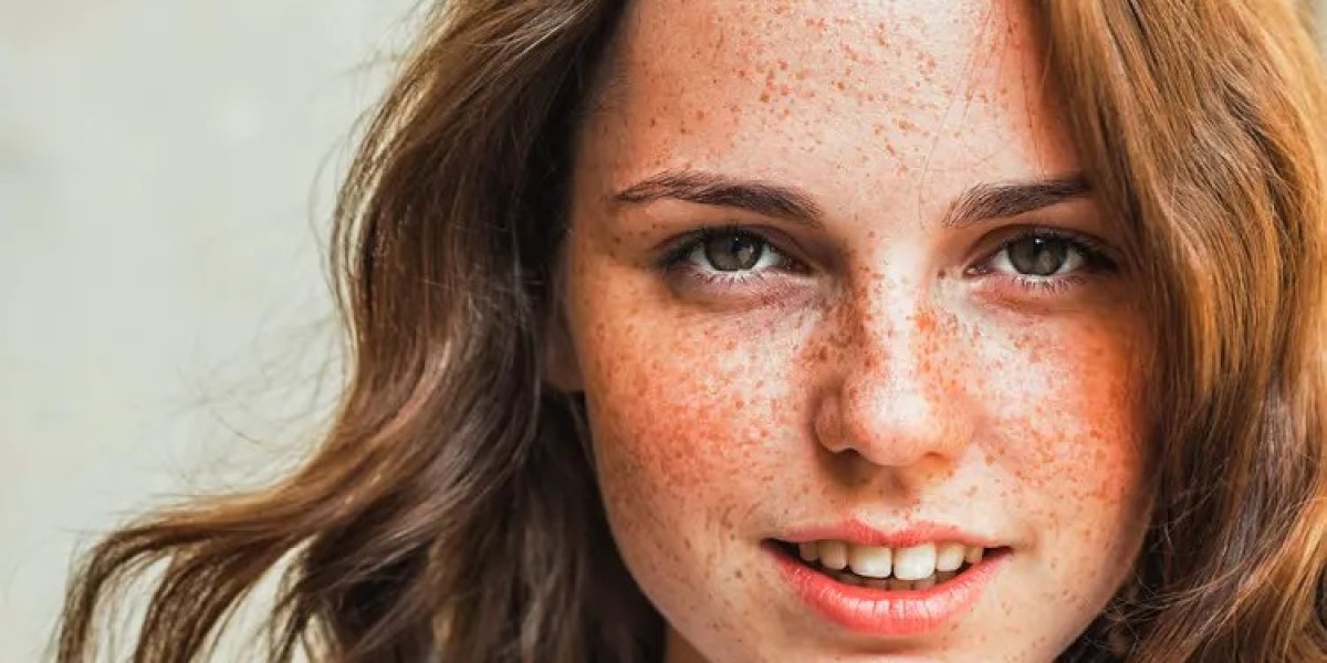 How Do Dermatologists Treat Freckles and Blemishes?