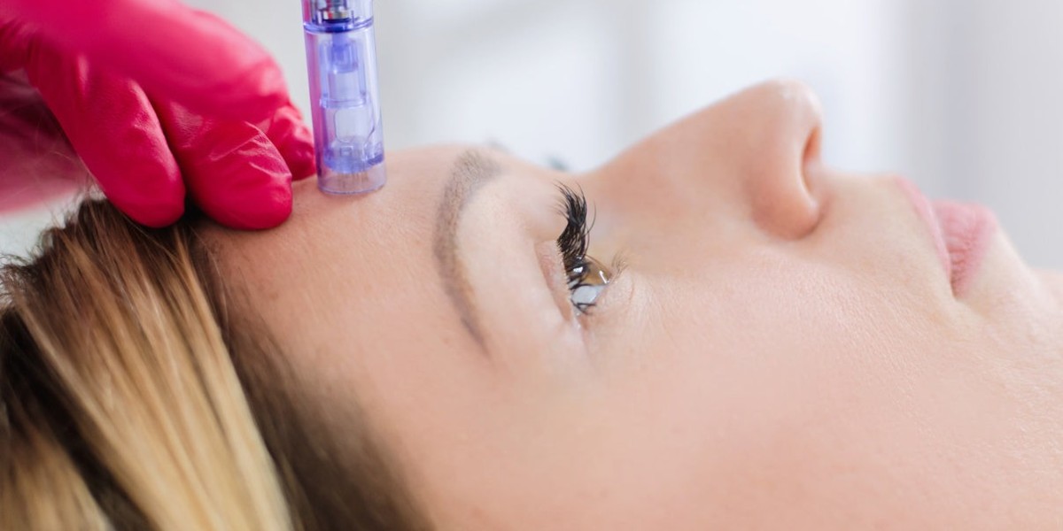 Is Microneedling Safe for Sensitive Skin?