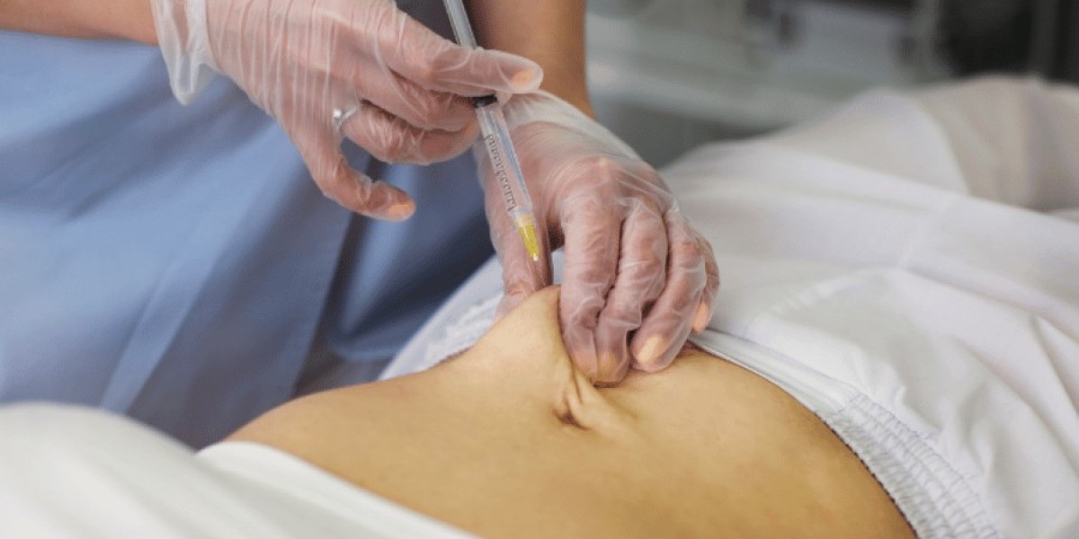 Does Lipolysis improve waistline shape?