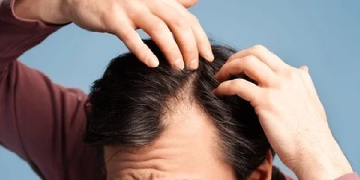 Hair Loss Treatment in Noida: Break Free from Hair Fall Myths