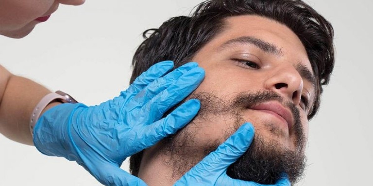 Natural Facial Hair Grafting Riyadh