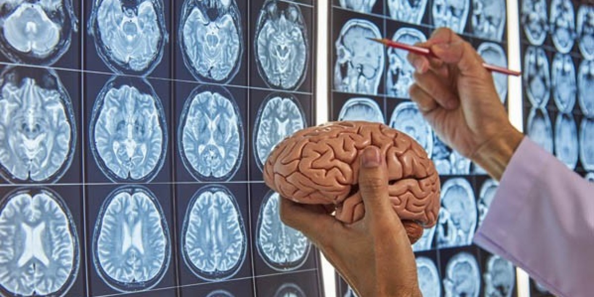 Neuro Sharp Reviews 2025: Can This Supplement Truly Enhance Brain Health?