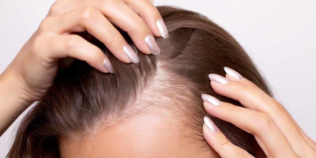 Restoring Confidence: The Science and Art of Modern Hair Restoration