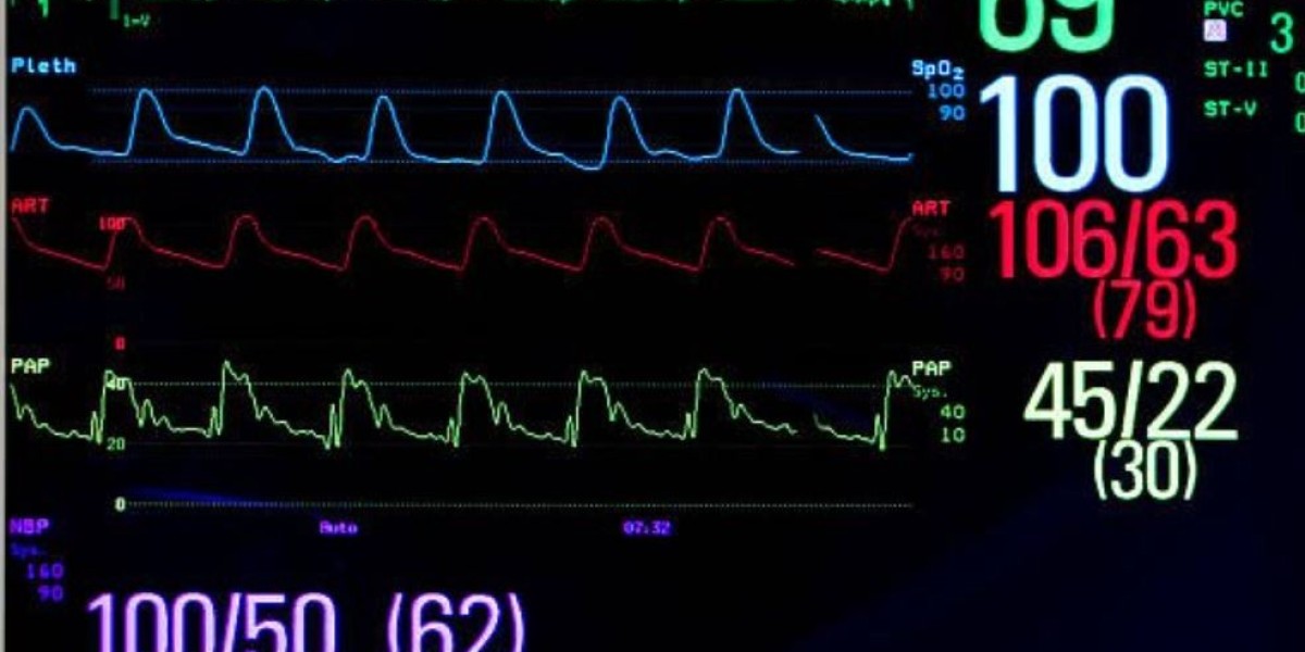 Hemodynamic Monitoring Market 2025-2033: Industry Size, Share, Growth, Key Players and Forecast Report