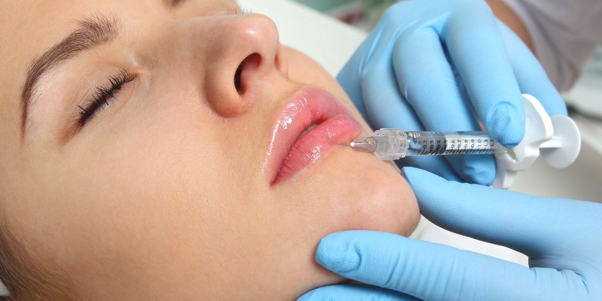 Lip Fillers Looks: Achieve That Soft, Plumped Finish