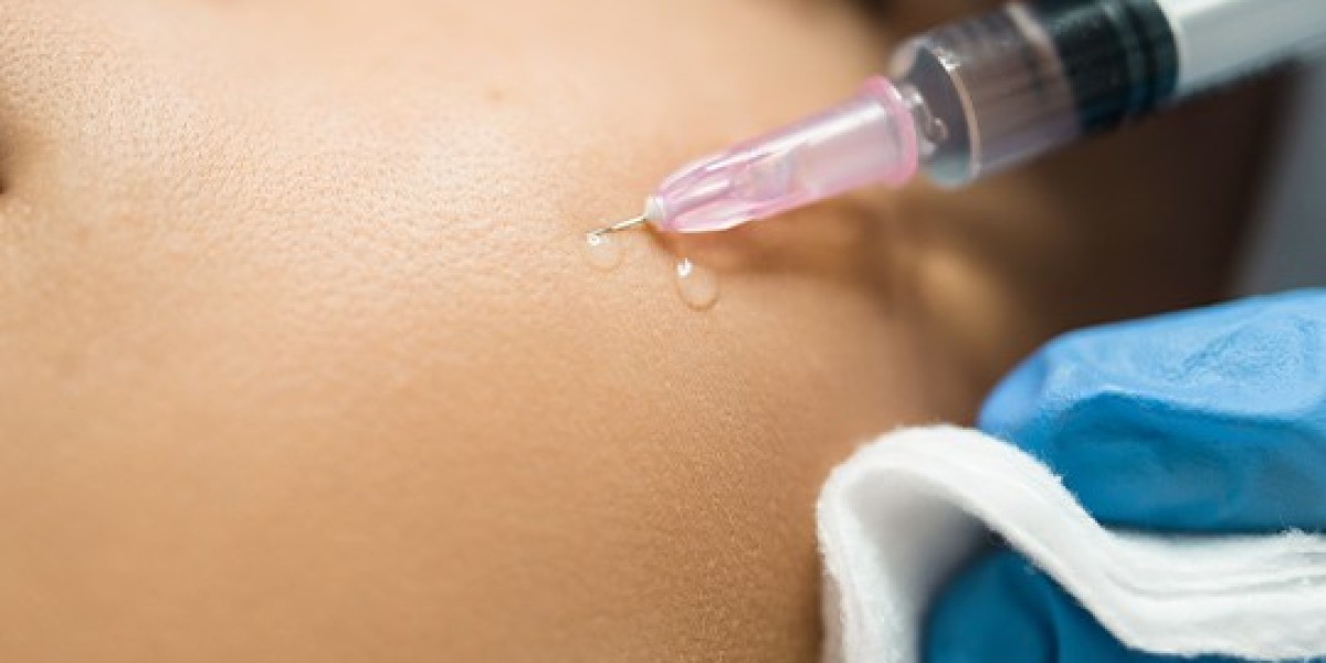 Cheek Fillers Injections Bring Effortless Sculpt And Facial Glow
