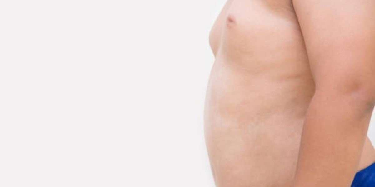 Gynecomastia in Islamabad: Modern Solutions for a Firm and Masculine Chest