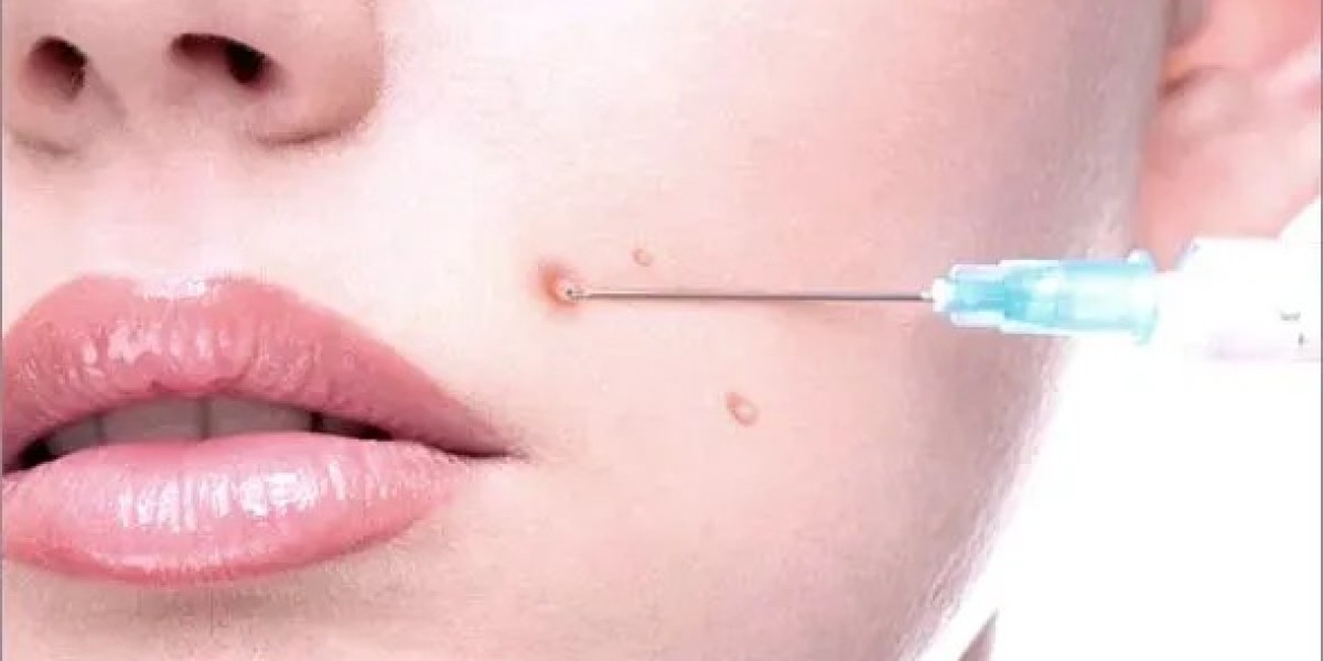 Dubai Dermatologists Reveal Why Kenalog Is Their Secret Weapon for Flawless Skin
