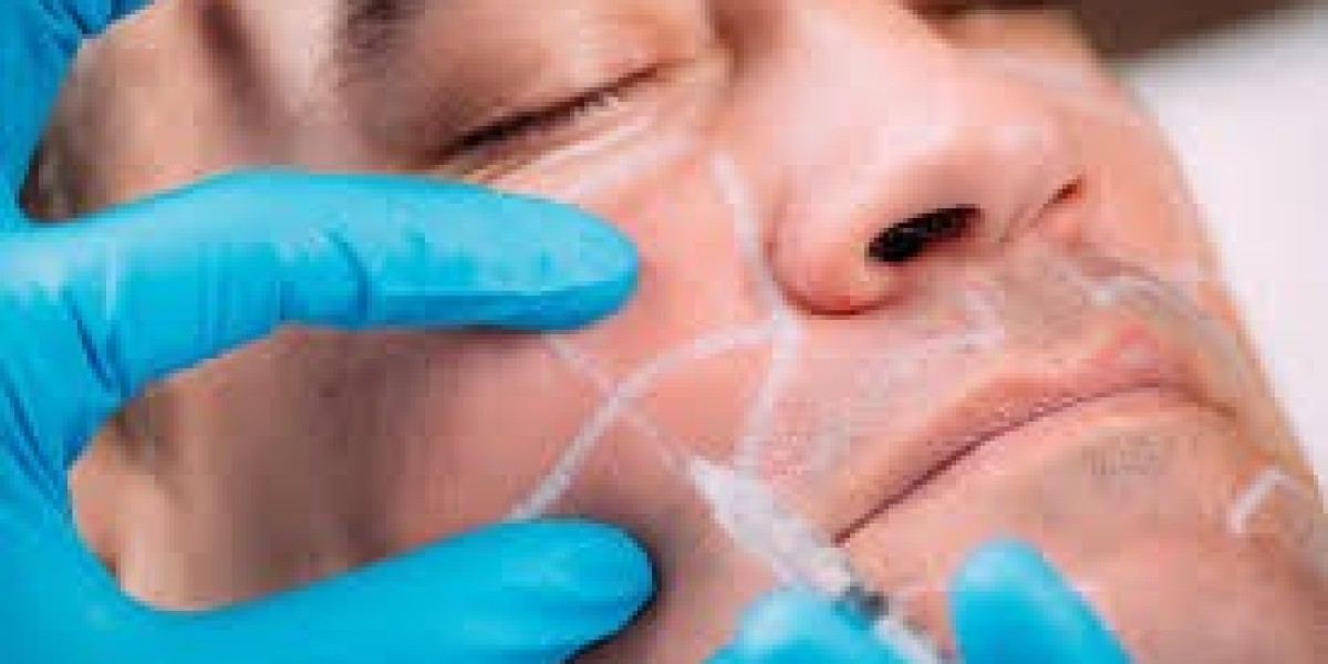 Are Cheek Filler Injections Safe and Appropriate for Men?