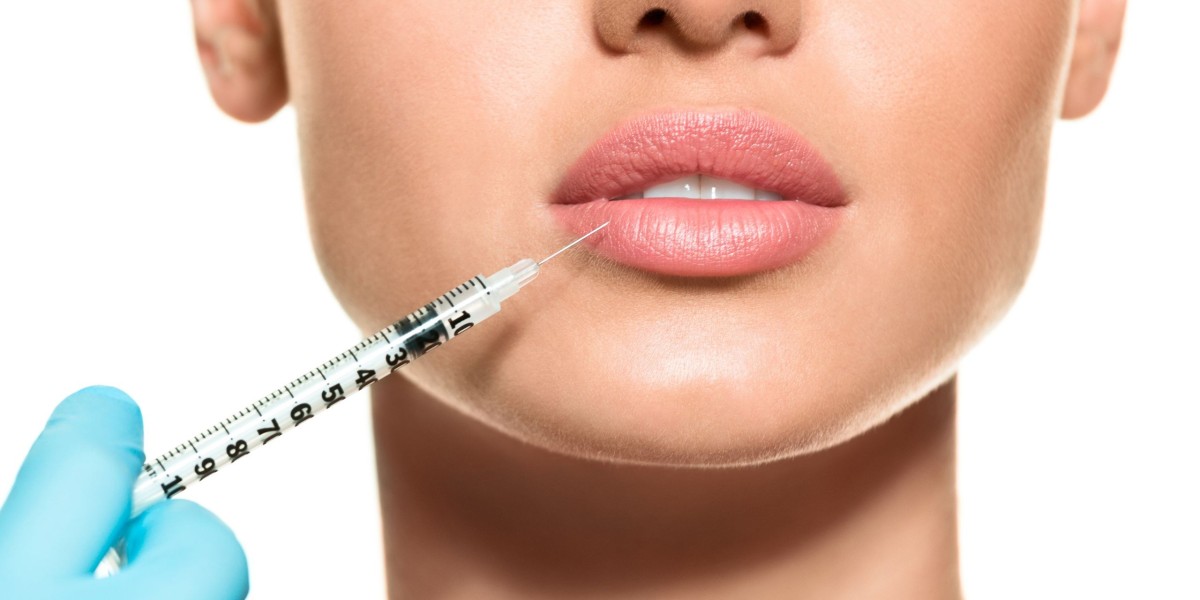 Is Juvederm a Popular Option for Enhancing Lip Shape and Adding Volume?