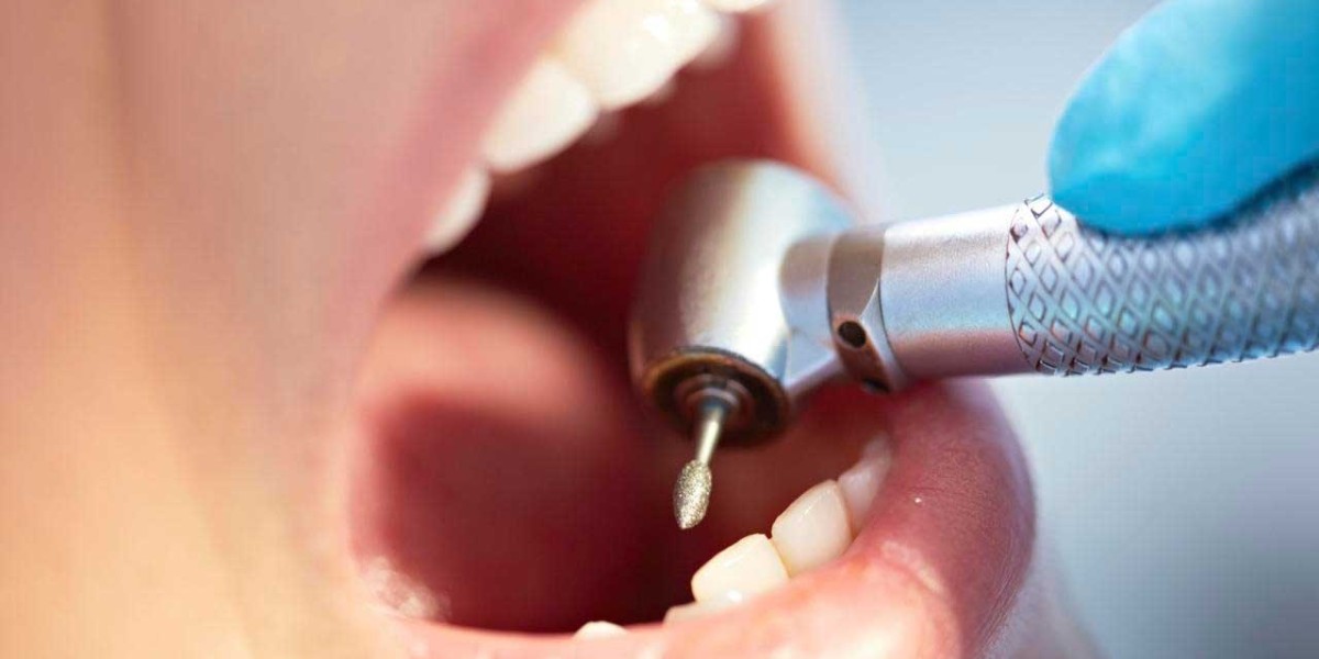 Porcelain Tooth Filling Cost and Durability