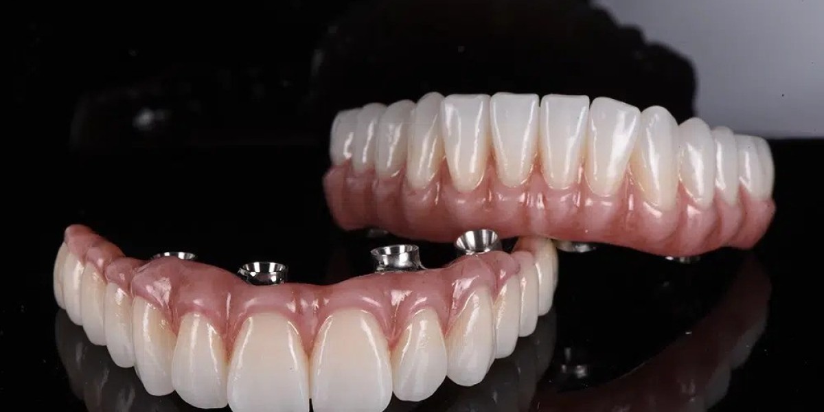 Dental Implants Brisbane: Restoring Your Smile with Confidence at Warner Lakes Dental
