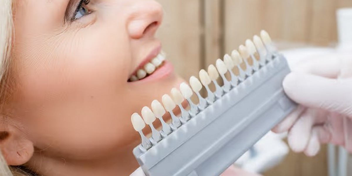 Dental Implants Sydney