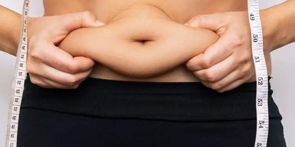 Mini vs. Full Tummy Tuck in Dubai: Which One Is Right for You?