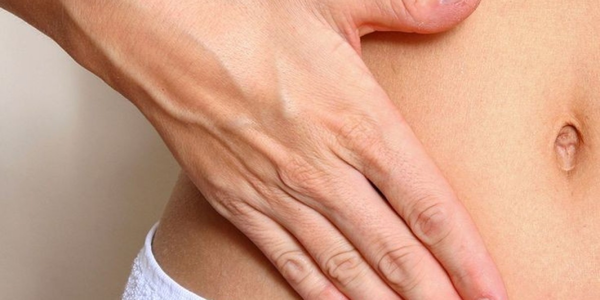 How to Maintain Liposuction Results in Riyadh