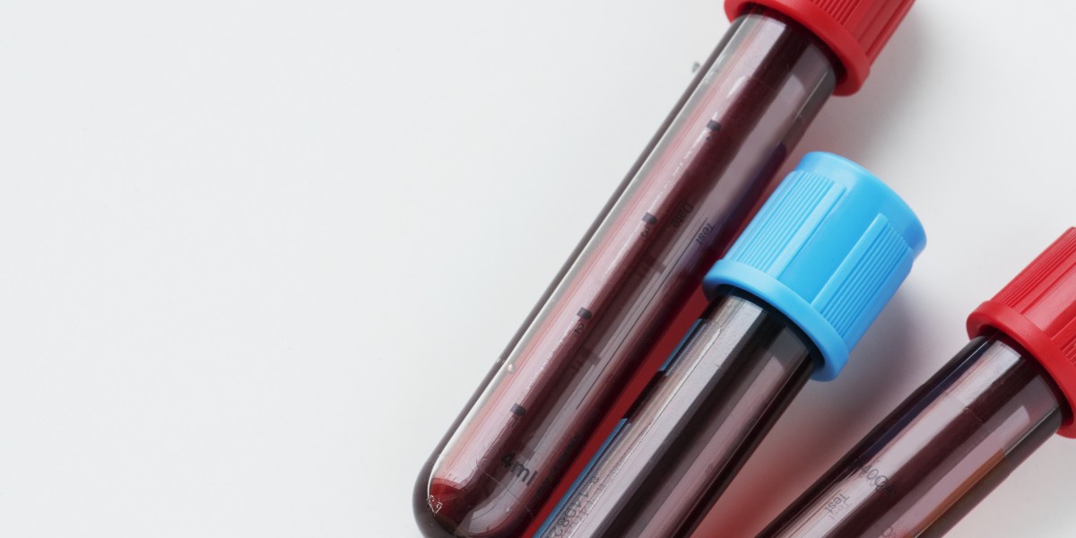 CBC Test in Ahmedabad: Importance, Process, Benefits & What to Expect
