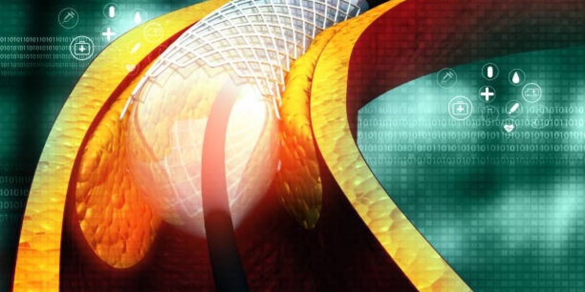 Drug-Eluting Stents Market: Growth Drivers, Innovations, and Future Outlook