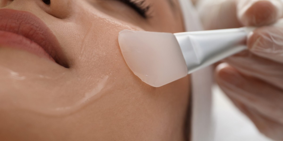 Do Chemical Peels Help with Wrinkles and Fine Lines?