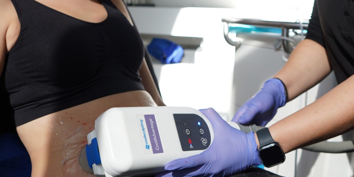 CoolSculpting Offers Targeted Fat Loss for a Confident Profile