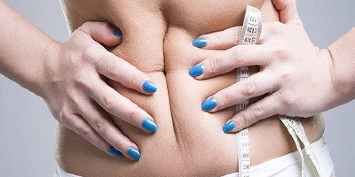 Can Undergoing a Tummy Tuck Enhance Your Body Posture?