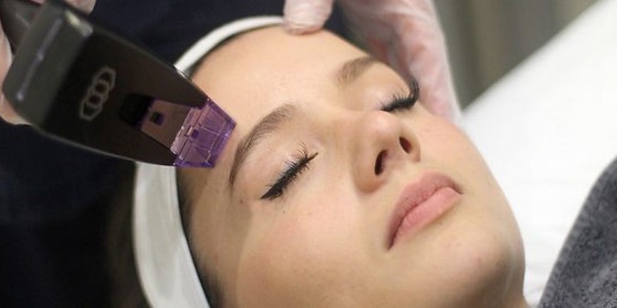 Morpheus8 for Fine Lines: Effective Solutions
