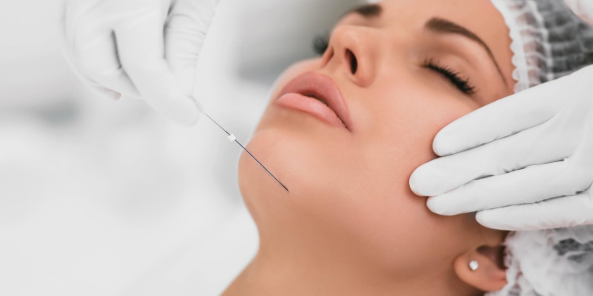 Can Thread Lift Treatment Reveal a Softer, Younger Look?