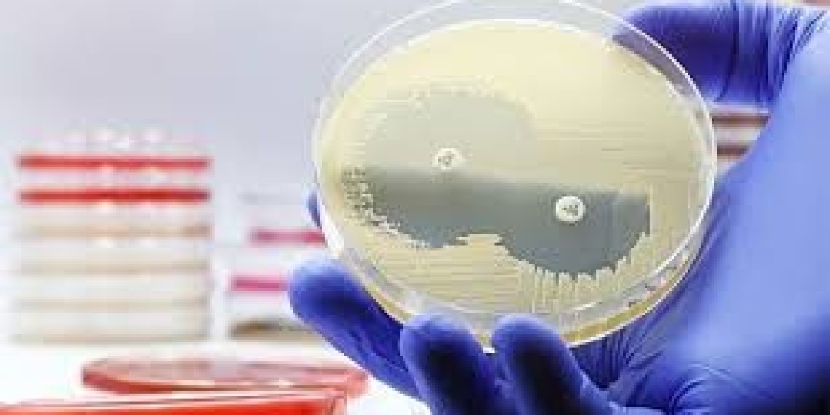 Antimicrobial Susceptibility Test Market revenue potential and investment insights for stakeholders and decision makers