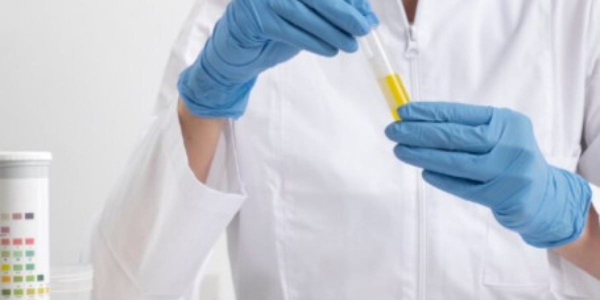 Decoding Your Urine AFB Report: What It Means for Tuberculosis Diagnosis
