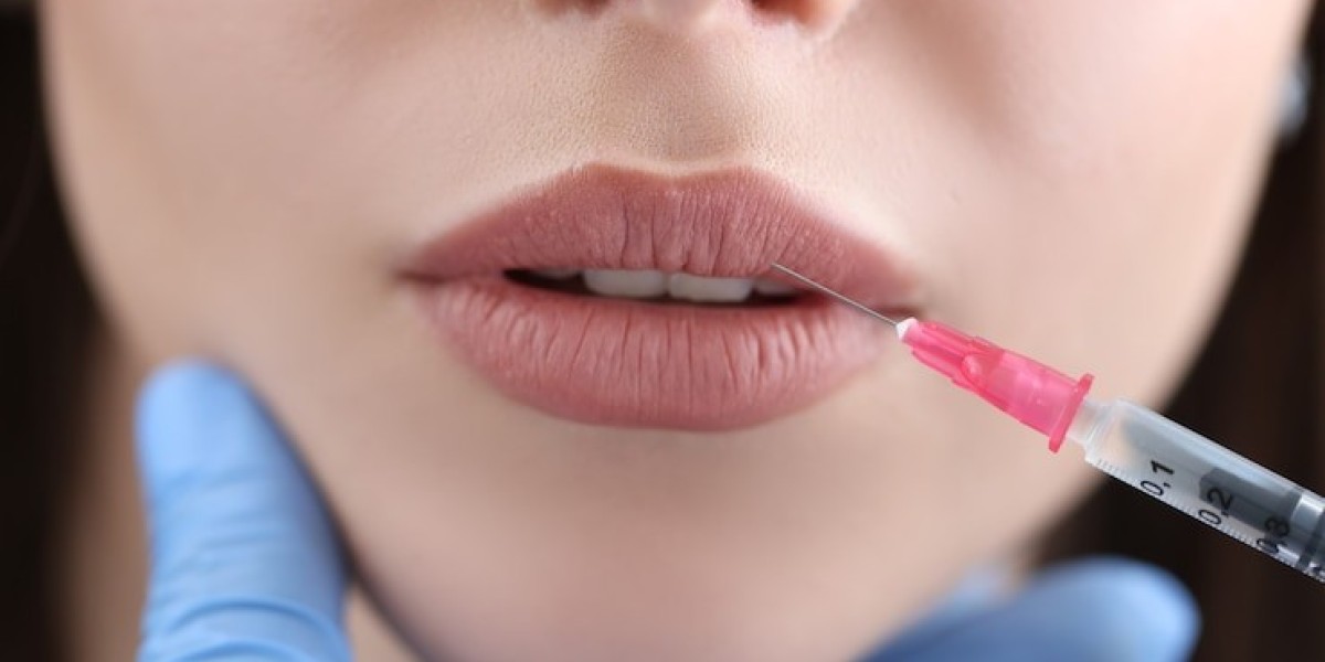 What Features Make Volbella Ideal for Adding Subtle Lip Fullness?