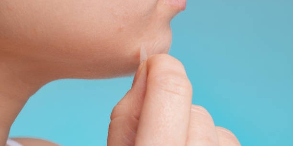 What Makes a Good Candidate for Double Chin Liposuction?