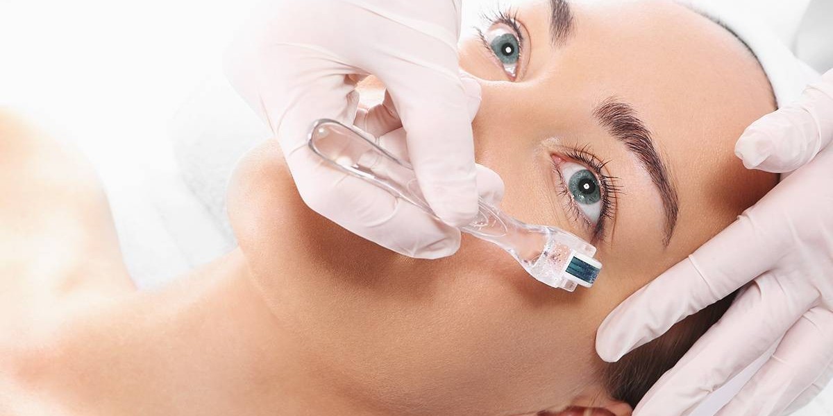 Best Dermapen Treatment for acne prone skin benefits?