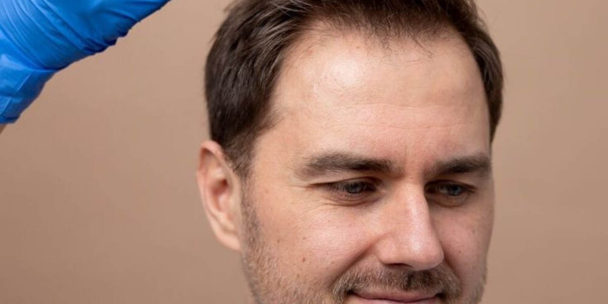 How Safe is Exosomes Hair Therapy in Dubai? Expert Insights