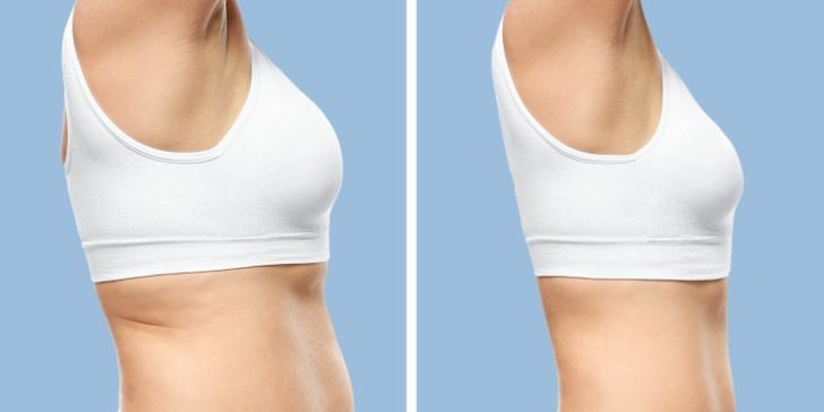 Wegovy in Dubai: Lifestyle Tips to Boost Your Weight-Loss Journey