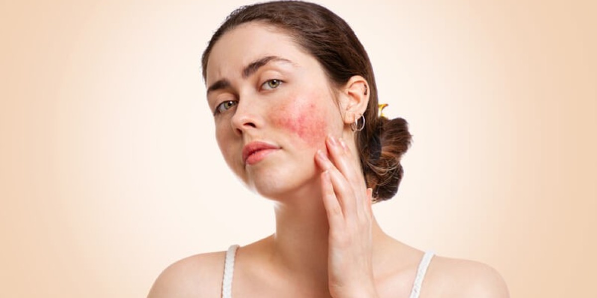 Can the Best Dermatologist Treat Sensitive Skin?