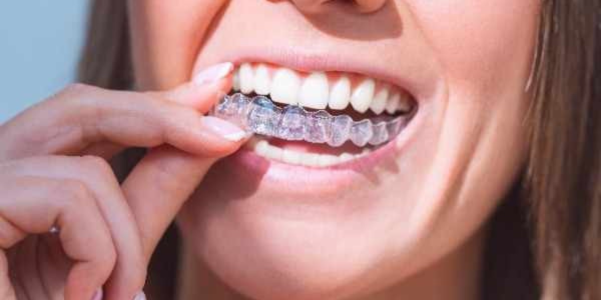 Closing Smile Gaps with Expert Invisalign Care in Bracknell