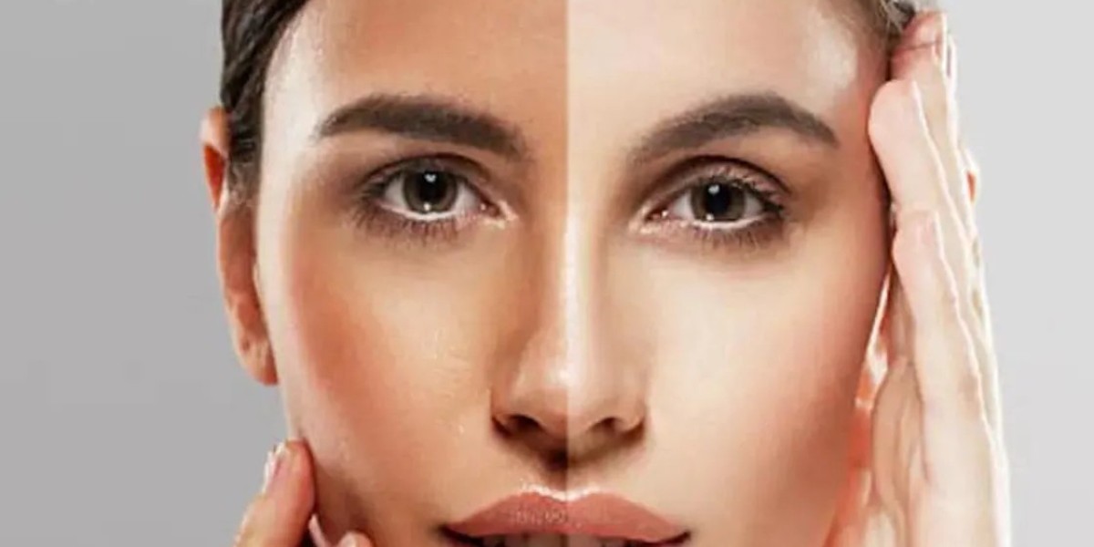 BioRay Whitening Injection in Dubai: What Influencers Won’t Tell You