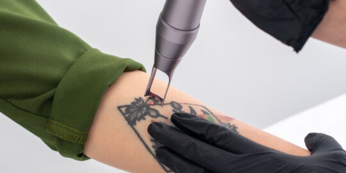 Complete Tattoo Erasing Riyadh Technology