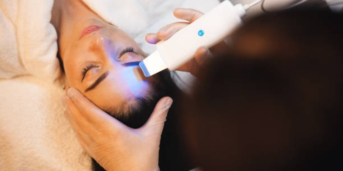 Laser Treatment in Dubai for Hyperpigmentation Fix