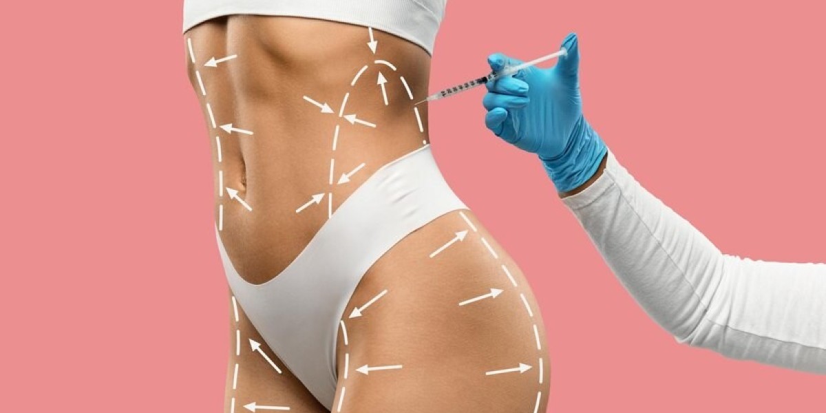 Liposuction in Dubai for Double Chin Reduction: Achieve a Slimmer, Defined Jawline
