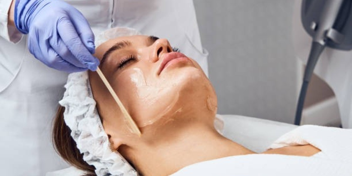 Can Chemical Peels Improve Sun-Damaged Skin?