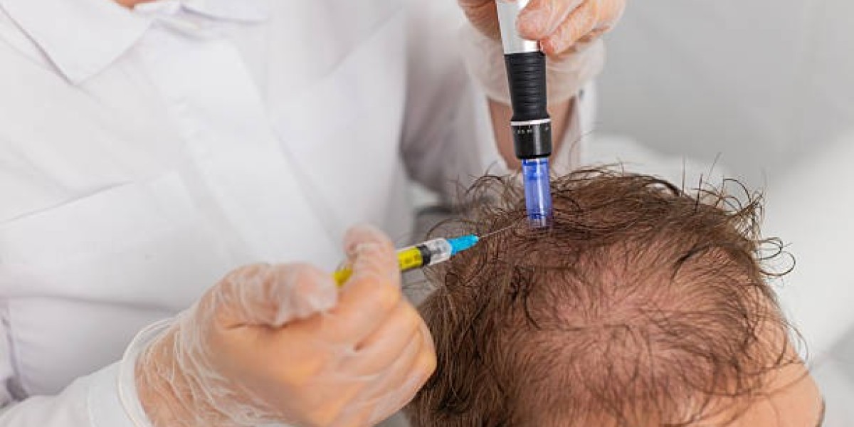 Exosomes Hair Therapy in Dubai: Cost vs Benefits