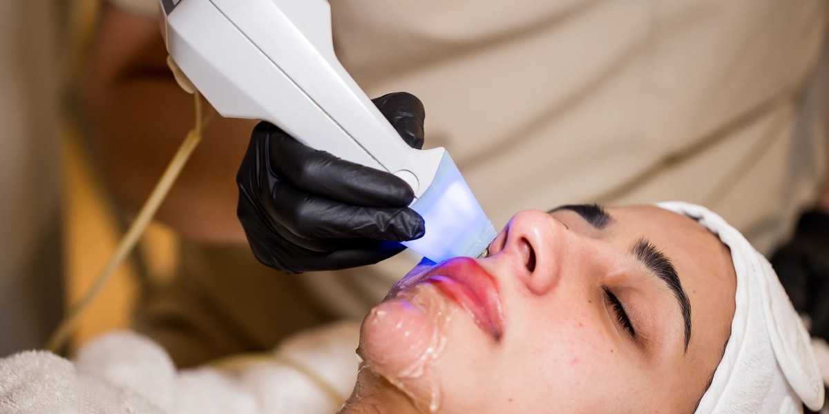 Can Exilis Therapy Improve Skin Firmness and Elasticity?