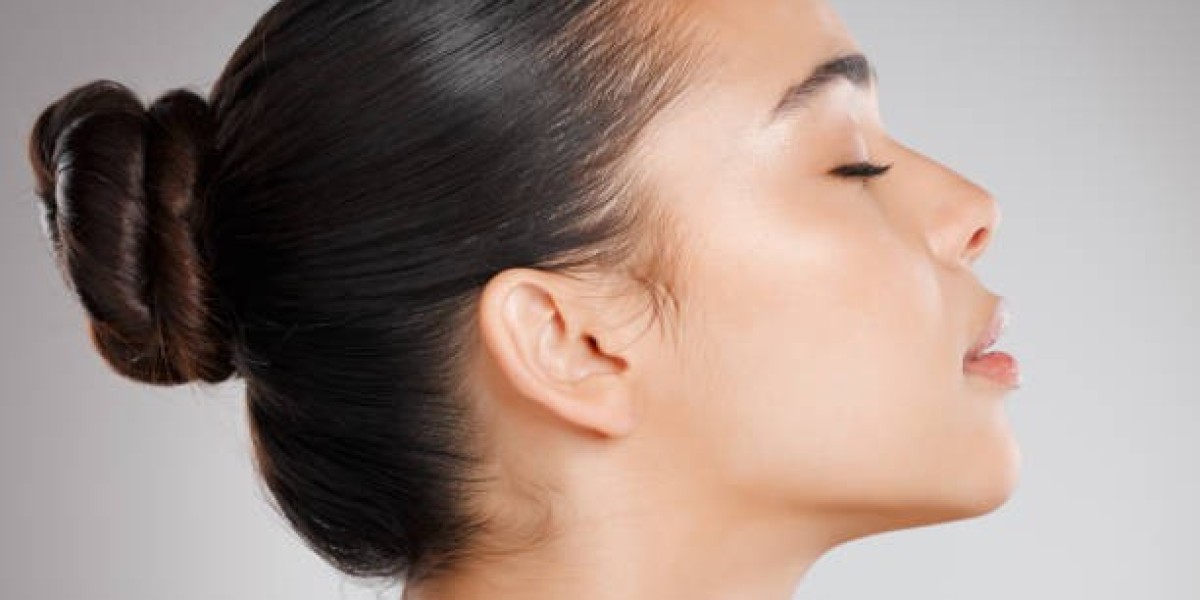 Can Sugar Thread Lift Define and Contour Your Jawline?