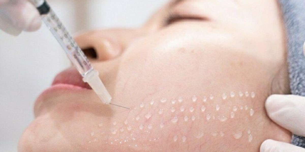 Mesotherapy in Dubai: Unlock Radiant, Youthful Skin Effortlessly