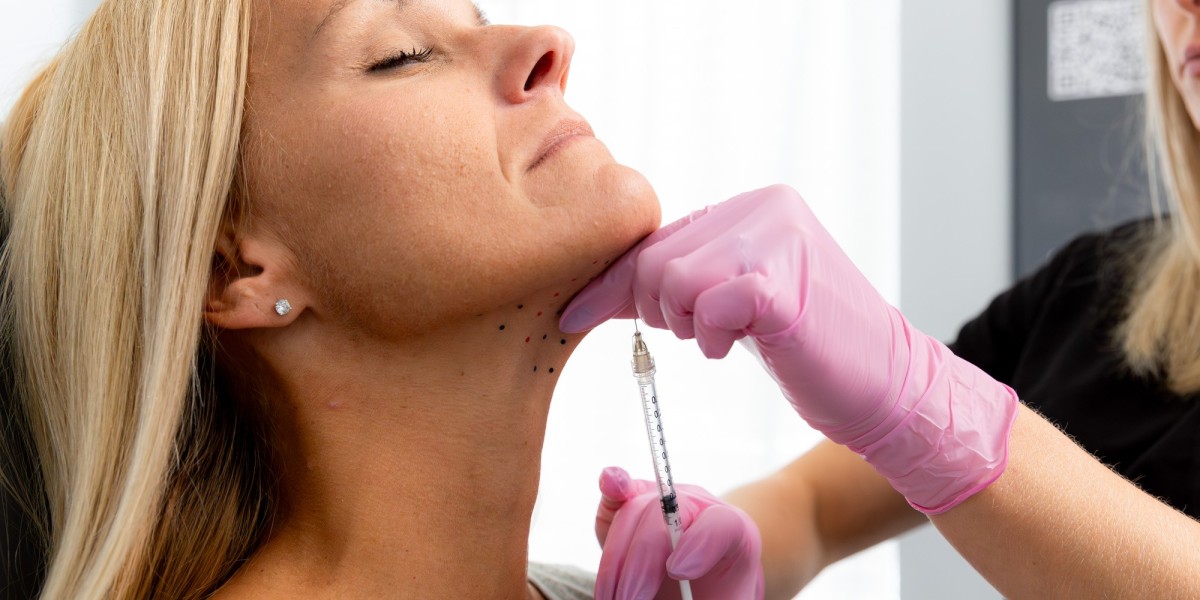 Is Kybella Worth It for Double Chin Removal?
