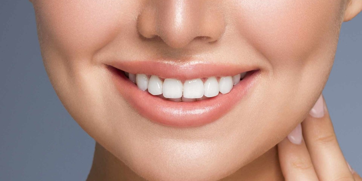 Composite Veneers vs Teeth Whitening: Which Is Right for You?