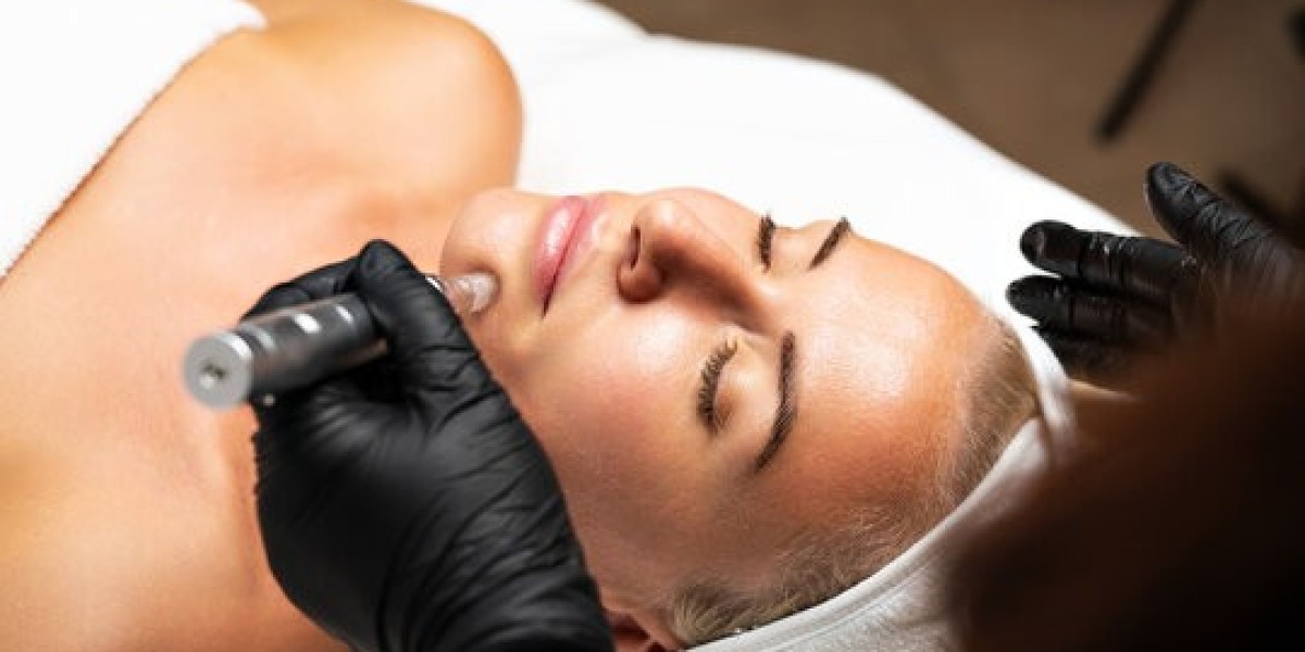 Refresh and Rejuvenate Skin with Microneedling PRP in Islamabad