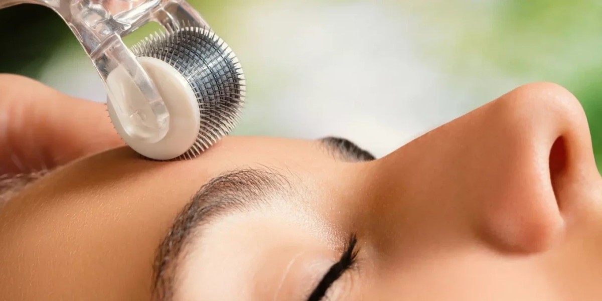 Can Derma Roller Treatment Help Reduce Pigmentation?